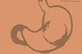 Intragastric balloon in place